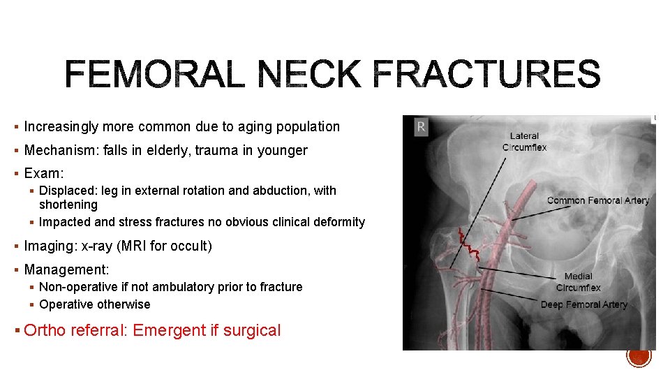 § Increasingly more common due to aging population § Mechanism: falls in elderly, trauma