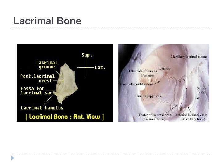 Lacrimal Bone 