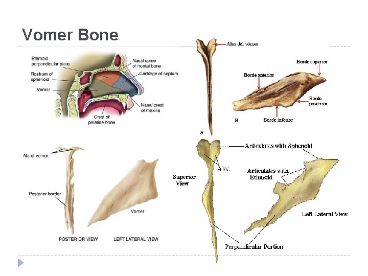 Vomer Bone 