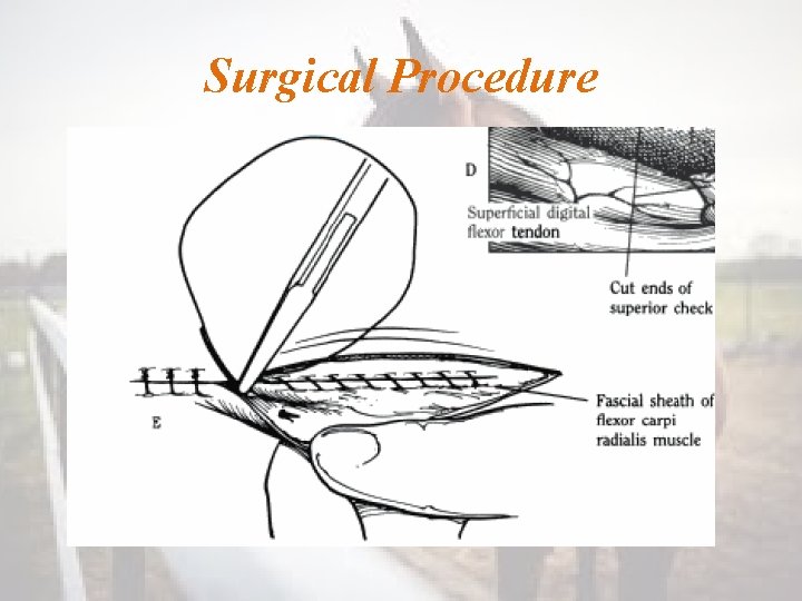 Surgical Procedure 