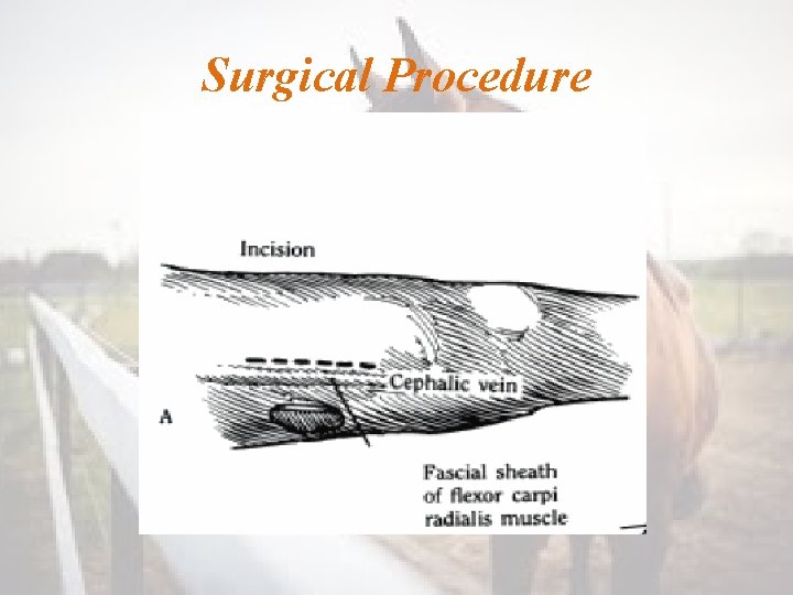 Surgical Procedure 