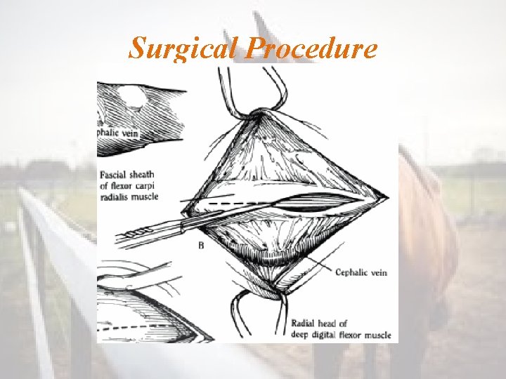 Surgical Procedure 