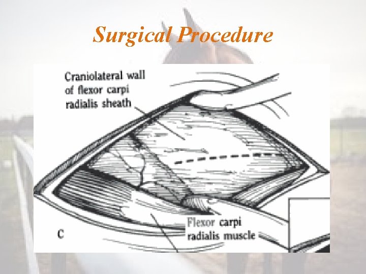 Surgical Procedure 