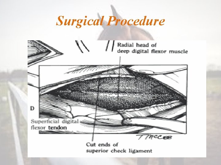 Surgical Procedure 