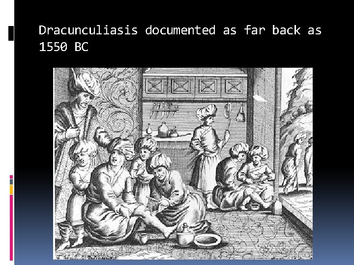 Dracunculiasis documented as far back as 1550 BC 