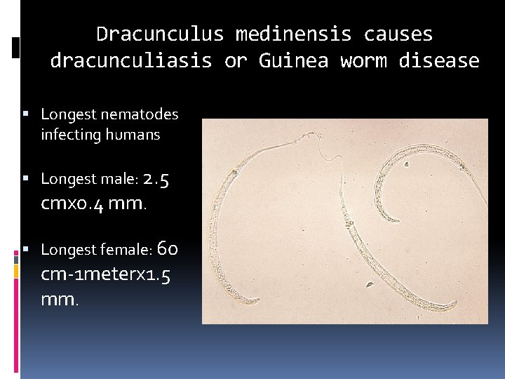 Dracunculus medinensis causes dracunculiasis or Guinea worm disease Longest nematodes infecting humans Longest male: