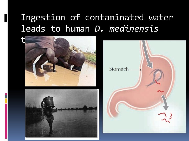 Ingestion of contaminated water leads to human D. medinensis transmission 