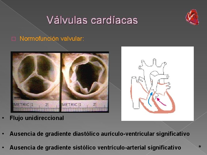 Válvulas cardíacas � Normofunción valvular: www. iun. edu • Flujo unidireccional • Ausencia de