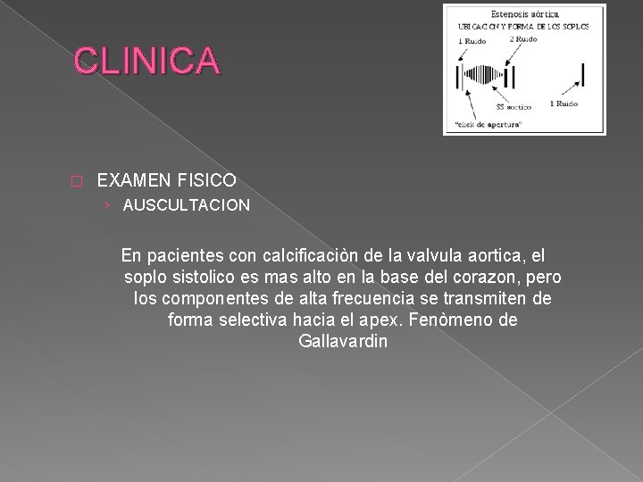 CLINICA � EXAMEN FISICO › AUSCULTACION En pacientes con calcificaciòn de la valvula aortica,