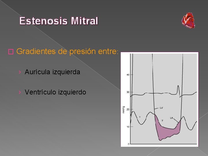 Estenosis Mitral � Gradientes de presión entre: › Aurícula izquierda › Ventrículo izquierdo 