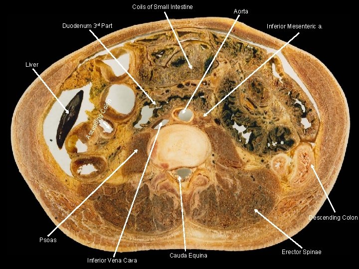Coils of Small Intestine Duodenum 3 rd Part Aorta Inferior Mesenteric a. As ce