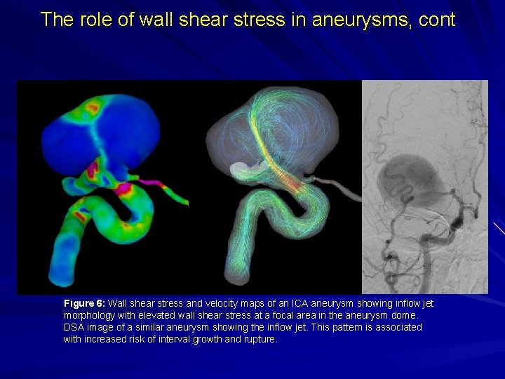 The role of wall shear stress in aneurysms, cont Figure 6: Wall shear stress