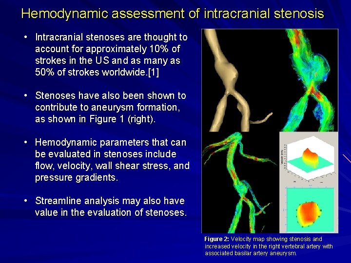 Hemodynamic assessment of intracranial stenosis • Intracranial stenoses are thought to account for approximately