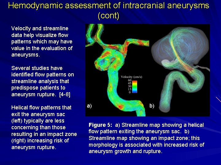 Hemodynamic assessment of intracranial aneurysms (cont) Velocity and streamline data help visualize flow patterns