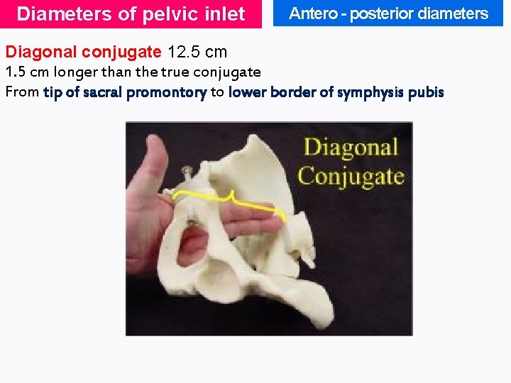 Diameters of pelvic inlet Antero - posterior diameters Diagonal conjugate 12. 5 cm 1.