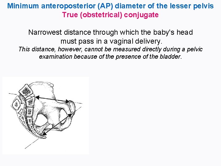 Minimum anteroposterior (AP) diameter of the lesser pelvis True (obstetrical) conjugate Narrowest distance through