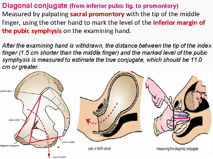 Diagonal conjugate (from inferior pubic lig. to promontory) Measured by palpating sacral promontory with