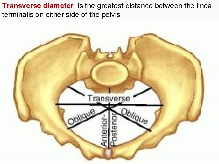 Transverse diameter is the greatest distance between the linea terminalis on either side of