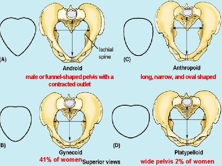 male or funnel-shaped pelvis with a contracted outlet 41% of women long, narrow, and