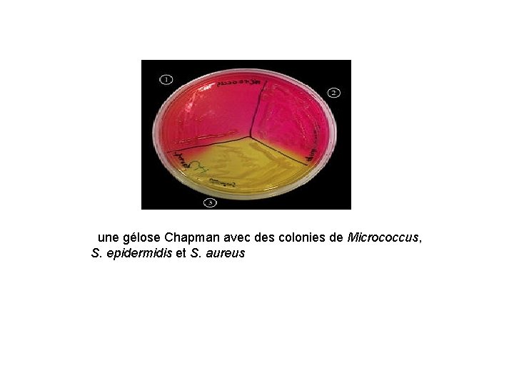  une gélose Chapman avec des colonies de Micrococcus, S. epidermidis et S. aureus