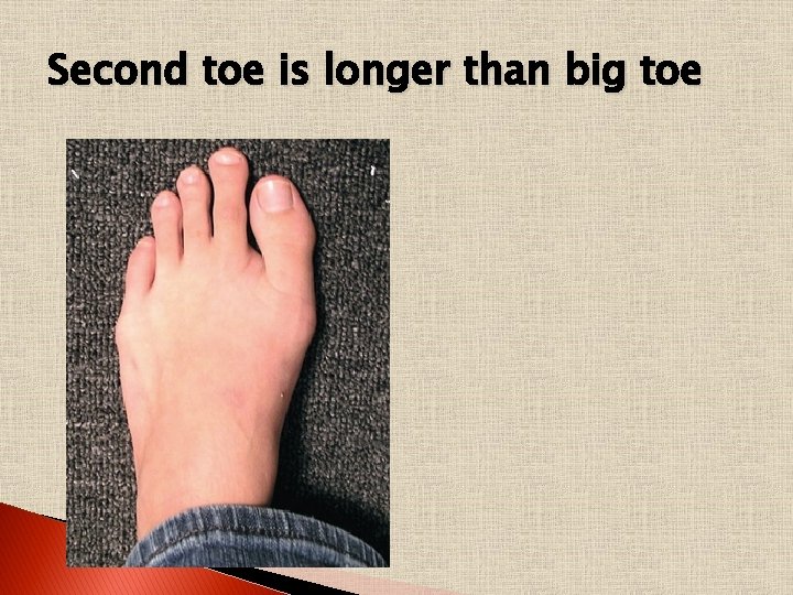 Second toe is longer than big toe 