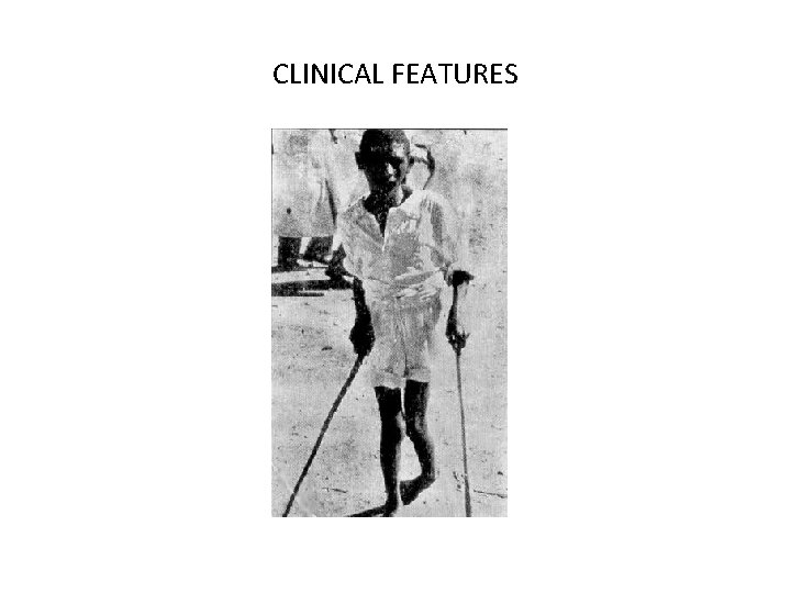 CLINICAL FEATURES 