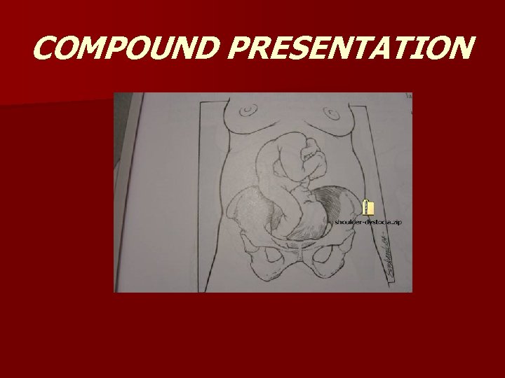COMPOUND PRESENTATION 