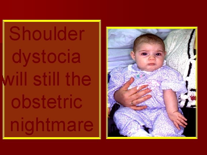 Shoulder dystocia will still the obstetric nightmare 