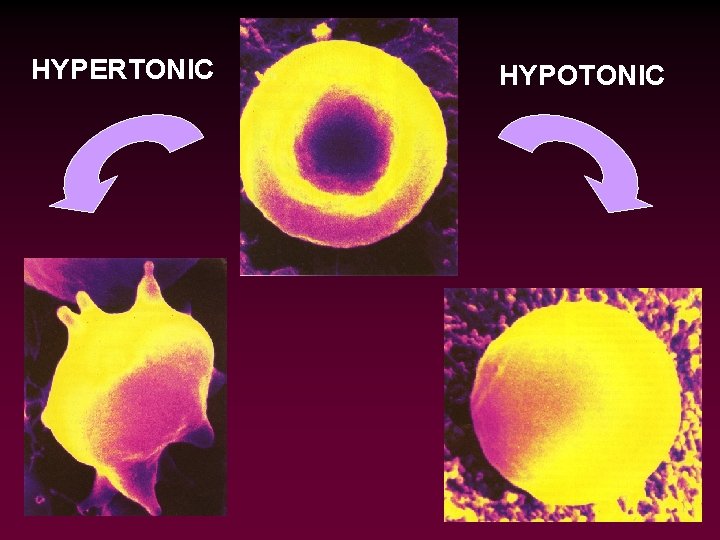 HYPERTONIC HYPOTONIC 