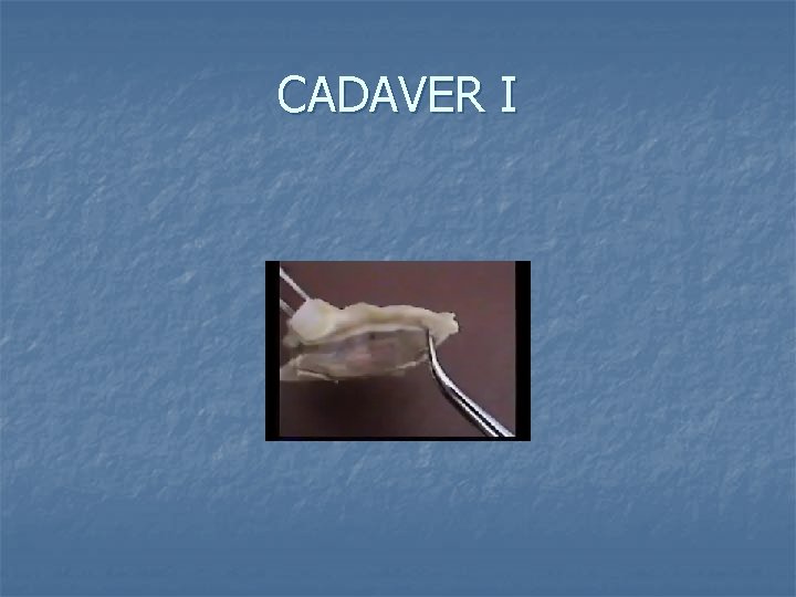 CADAVER I 