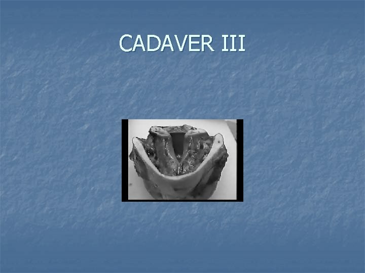 CADAVER III 