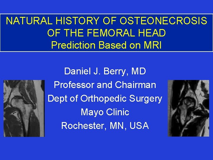 NATURAL HISTORY OF OSTEONECROSIS OF THE FEMORAL HEAD Prediction Based on MRI Daniel J.