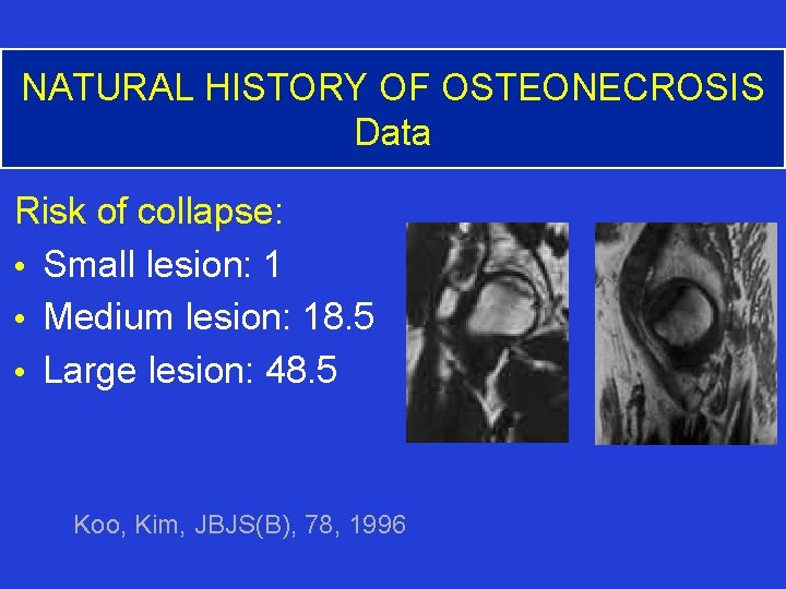 NATURAL HISTORY OF OSTEONECROSIS Data Risk of collapse: • Small lesion: 1 • Medium