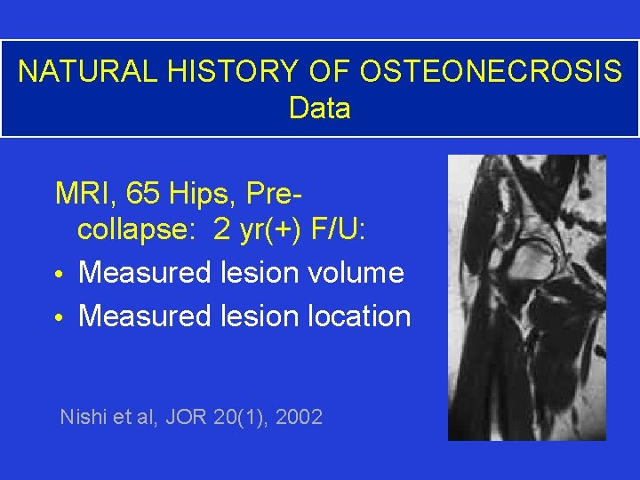 NATURAL HISTORY OF OSTEONECROSIS Data MRI, 65 Hips, Precollapse: 2 yr(+) F/U: • Measured