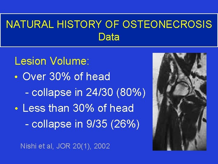NATURAL HISTORY OF OSTEONECROSIS Data Lesion Volume: • Over 30% of head - collapse
