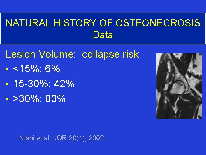 NATURAL HISTORY OF OSTEONECROSIS Data Lesion Volume: collapse risk • <15%: 6% • 15