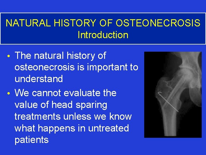 NATURAL HISTORY OF OSTEONECROSIS Introduction • The natural history of osteonecrosis is important to