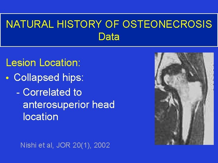 NATURAL HISTORY OF OSTEONECROSIS Data Lesion Location: • Collapsed hips: - Correlated to anterosuperior