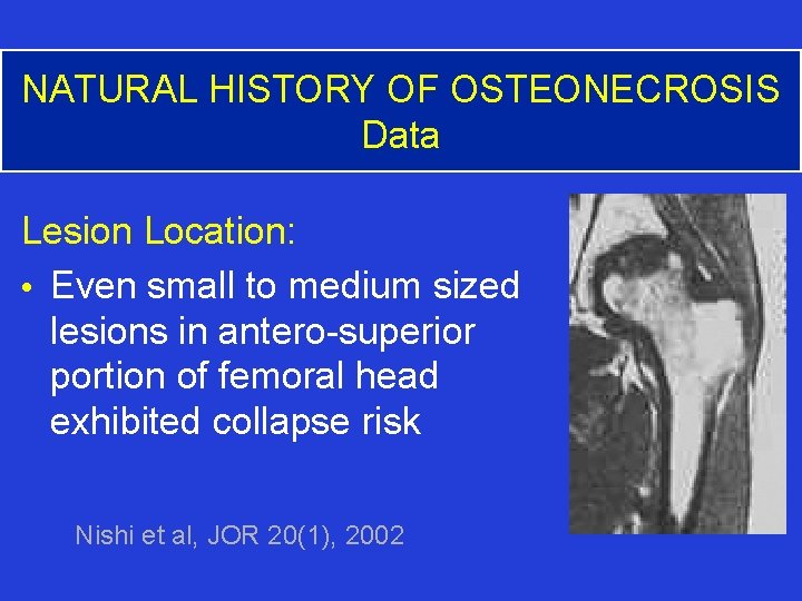 NATURAL HISTORY OF OSTEONECROSIS Data Lesion Location: • Even small to medium sized lesions