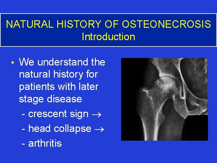 NATURAL HISTORY OF OSTEONECROSIS Introduction • We understand the natural history for patients with