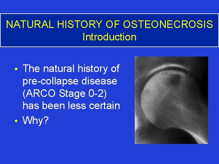 NATURAL HISTORY OF OSTEONECROSIS Introduction • The natural history of pre-collapse disease (ARCO Stage