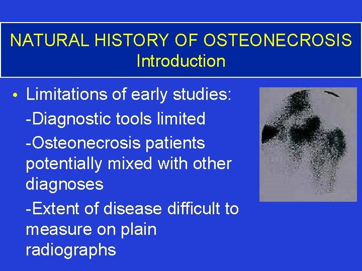NATURAL HISTORY OF OSTEONECROSIS Introduction • Limitations of early studies: -Diagnostic tools limited -Osteonecrosis