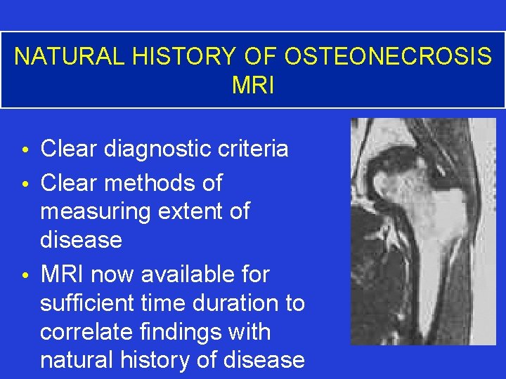 NATURAL HISTORY OF OSTEONECROSIS MRI • Clear diagnostic criteria • Clear methods of measuring