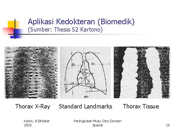 Aplikasi Kedokteran (Biomedik) (Sumber: Thesis S 2 Kartono) Thorax X-Ray Kamis, 8 Oktober 2009