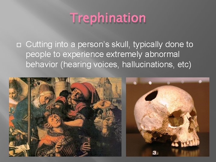 Trephination Cutting into a person’s skull, typically done to people to experience extremely abnormal