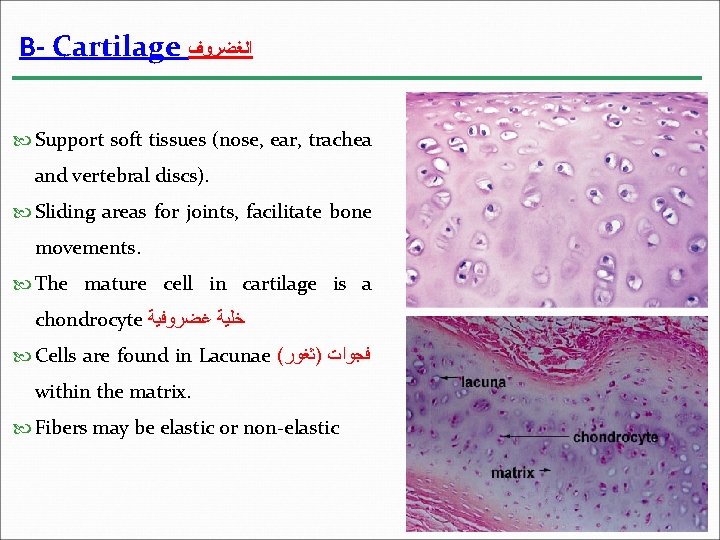 B- Cartilage ﺍﻟﻐﻀﺮﻭﻑ Support soft tissues (nose, ear, trachea and vertebral discs). Sliding areas