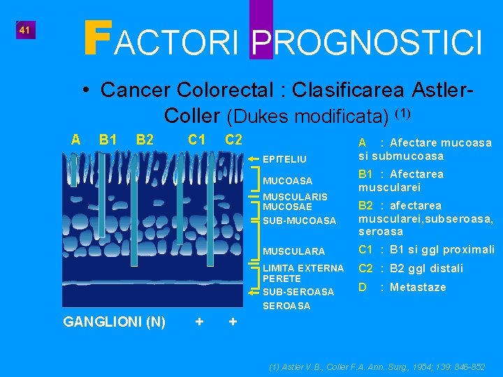 FACTORI PROGNOSTICI 41 • Cancer Colorectal : Clasificarea Astler. Coller (Dukes modificata) (1) A