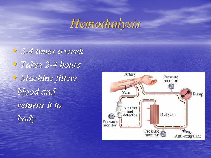 Hemodialysis • 3 -4 times a week • Takes 2 -4 hours • Machine