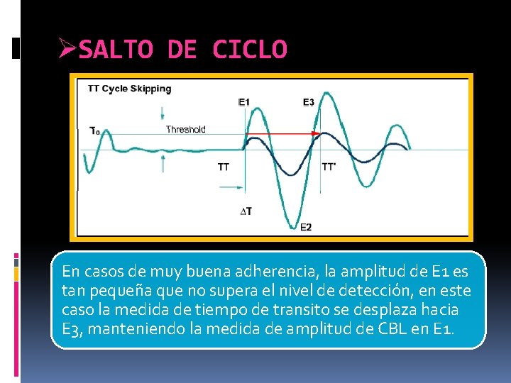 ØSALTO DE CICLO En casos de muy buena adherencia, la amplitud de E 1