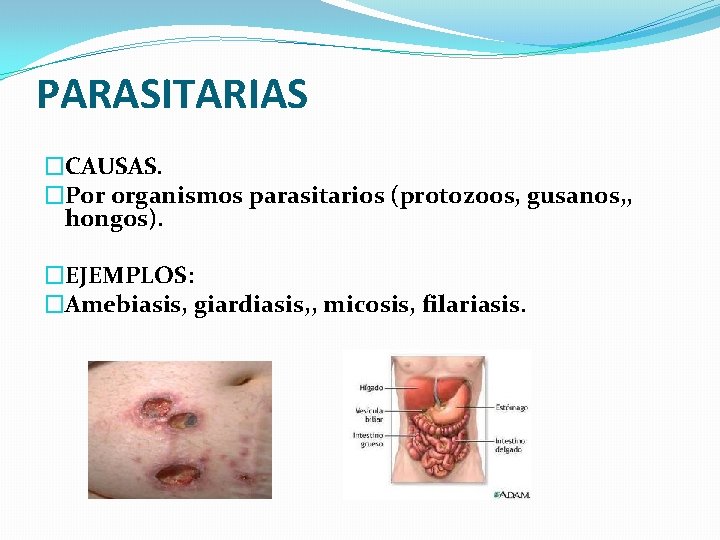 PARASITARIAS �CAUSAS. �Por organismos parasitarios (protozoos, gusanos, , hongos). �EJEMPLOS: �Amebiasis, giardiasis, , micosis, PARASITARIAS �CAUSAS. �Por organismos parasitarios (protozoos, gusanos, , hongos). �EJEMPLOS: �Amebiasis, giardiasis, , micosis,